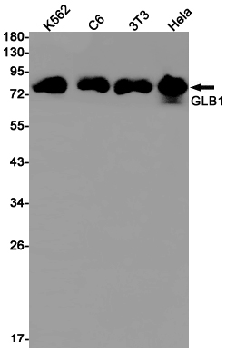 GLB1/Beta-galactosidase Rabbit mAb ABZ2968