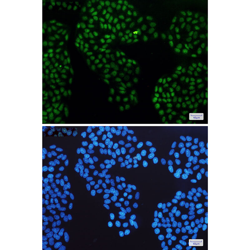 Glucocorticoid Receptor Rabbit mAb ABZ2969