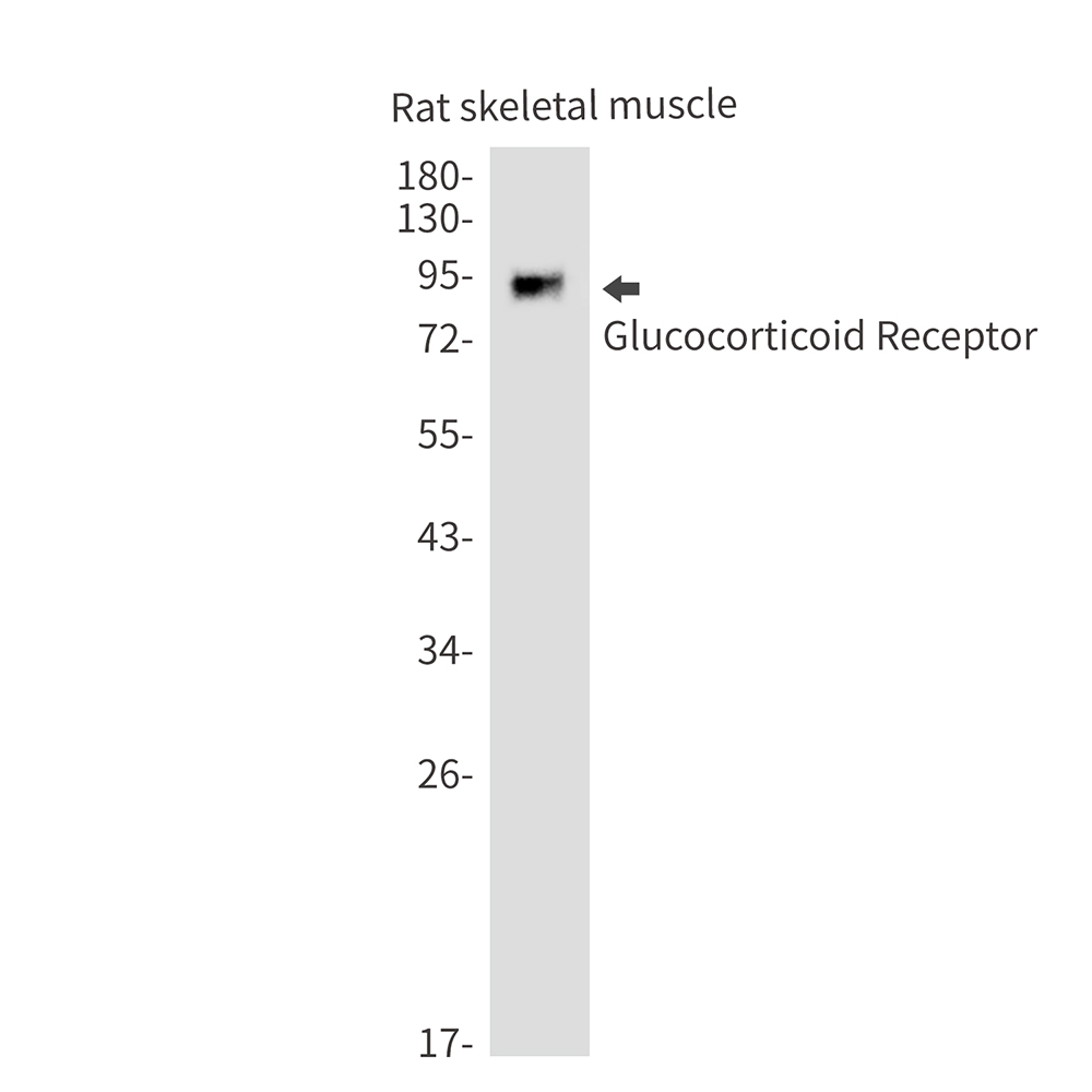 Glucocorticoid Receptor Rabbit mAb ABZ2969