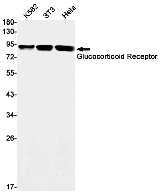 Glucocorticoid Receptor Rabbit mAb ABZ2969