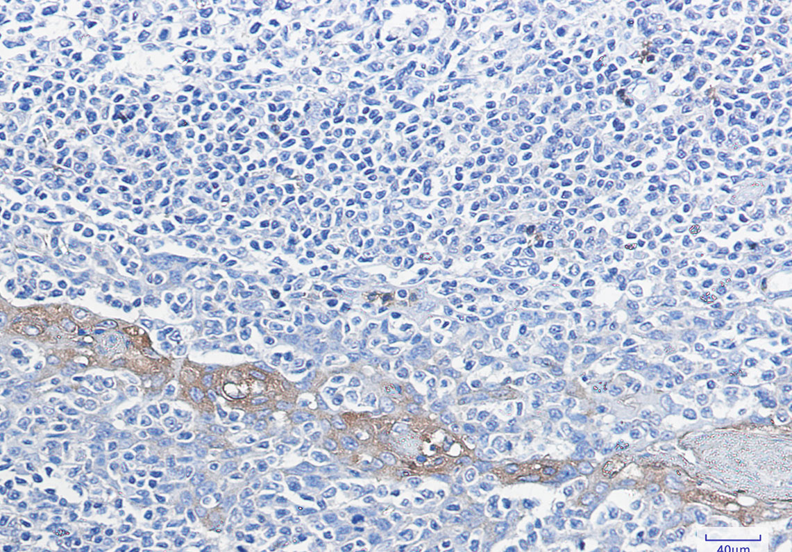 Glucose 6 Phosphate Dehydrogenase Rabbit mAb ABZ2970