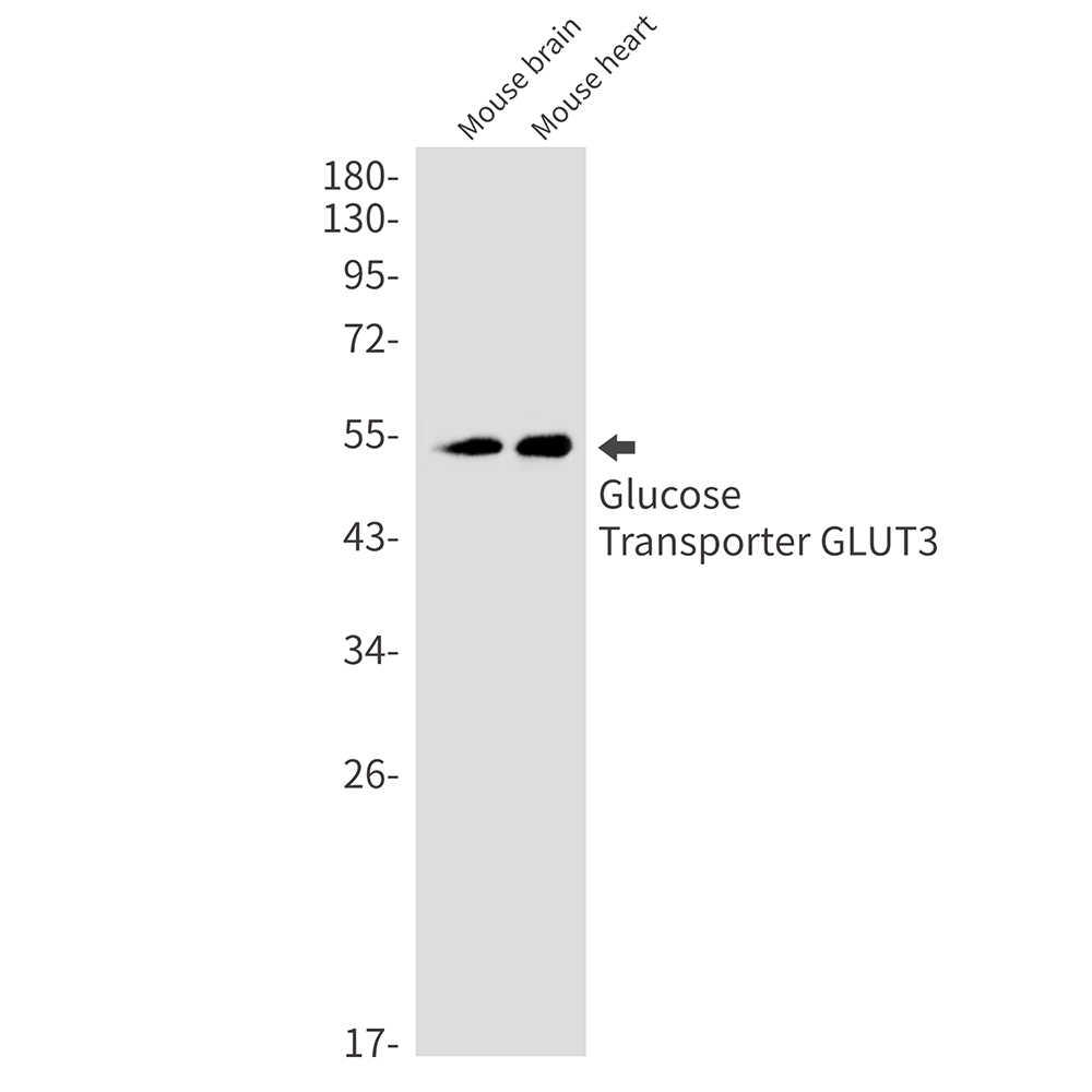 Glucose Transporter GLUT3 Rabbit mAb ABZ2971