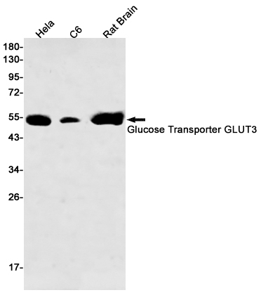 Glucose Transporter GLUT3 Rabbit mAb ABZ2971