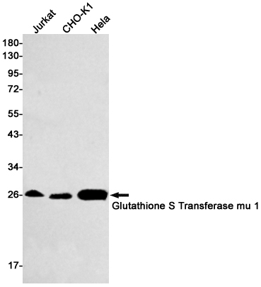 Glutathione S Transferase mu 1 Rabbit mAb ABZ2972