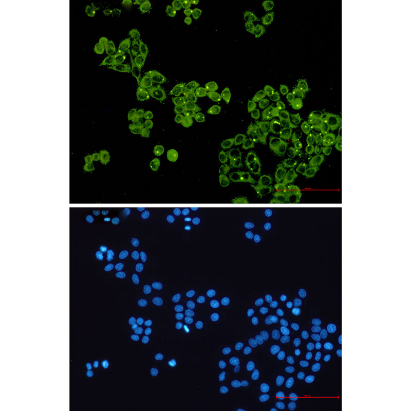 Glycogen synthase 1/GYS1 Rabbit mAb ABZ2974