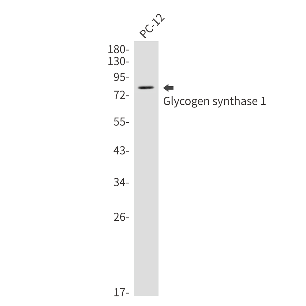 Glycogen synthase 1/GYS1 Rabbit mAb ABZ2974