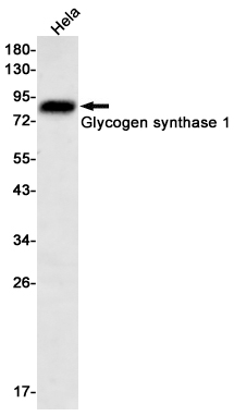 Glycogen synthase 1/GYS1 Rabbit mAb ABZ2974