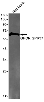 GPR37 Rabbit mAb ABZ2975