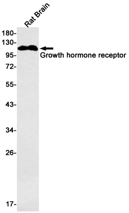 Growth Hormone Receptor Rabbit mAb ABZ2977