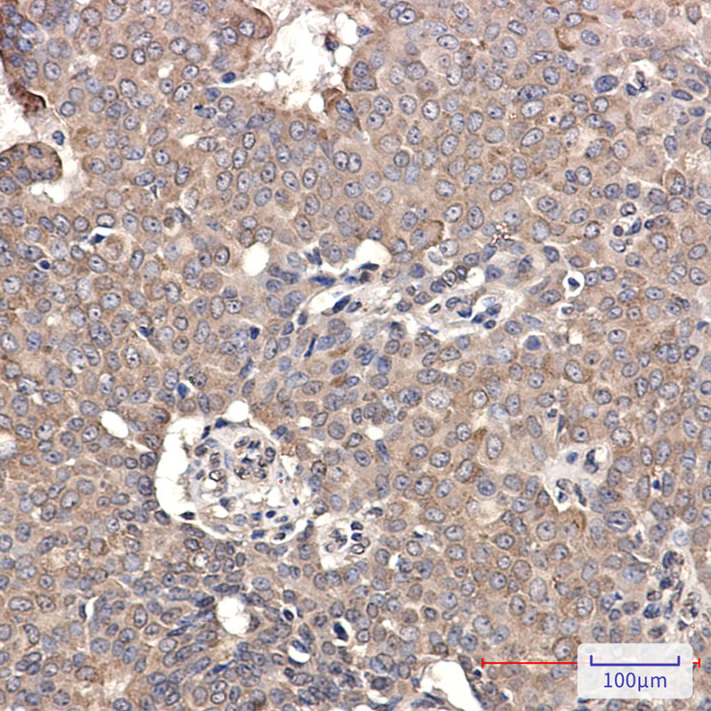 GRP78 BiP Rabbit mAb ABZ2978