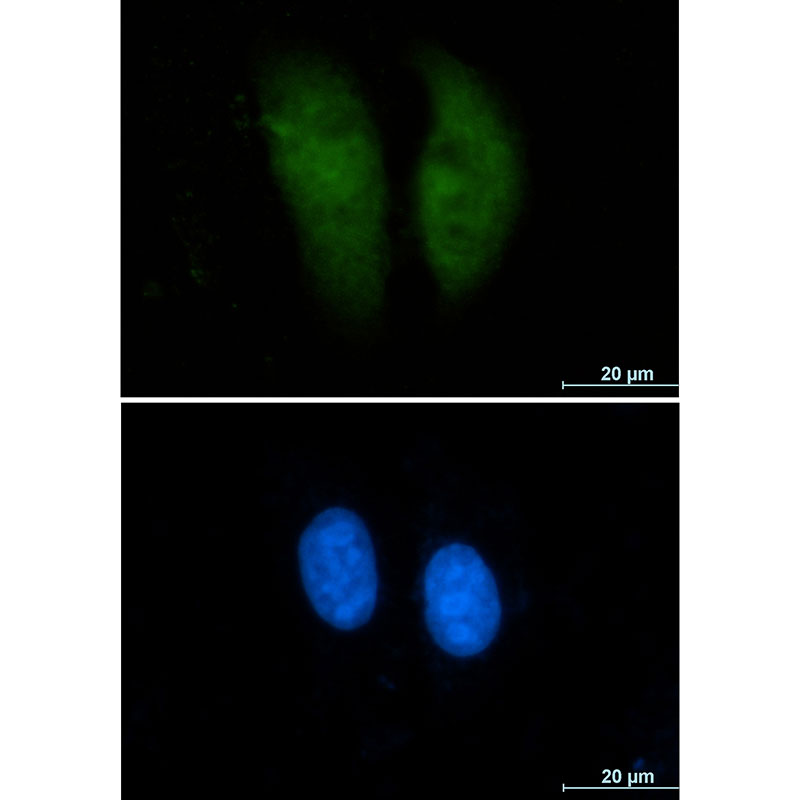GST3 / GST pi Rabbit mAb ABZ2979