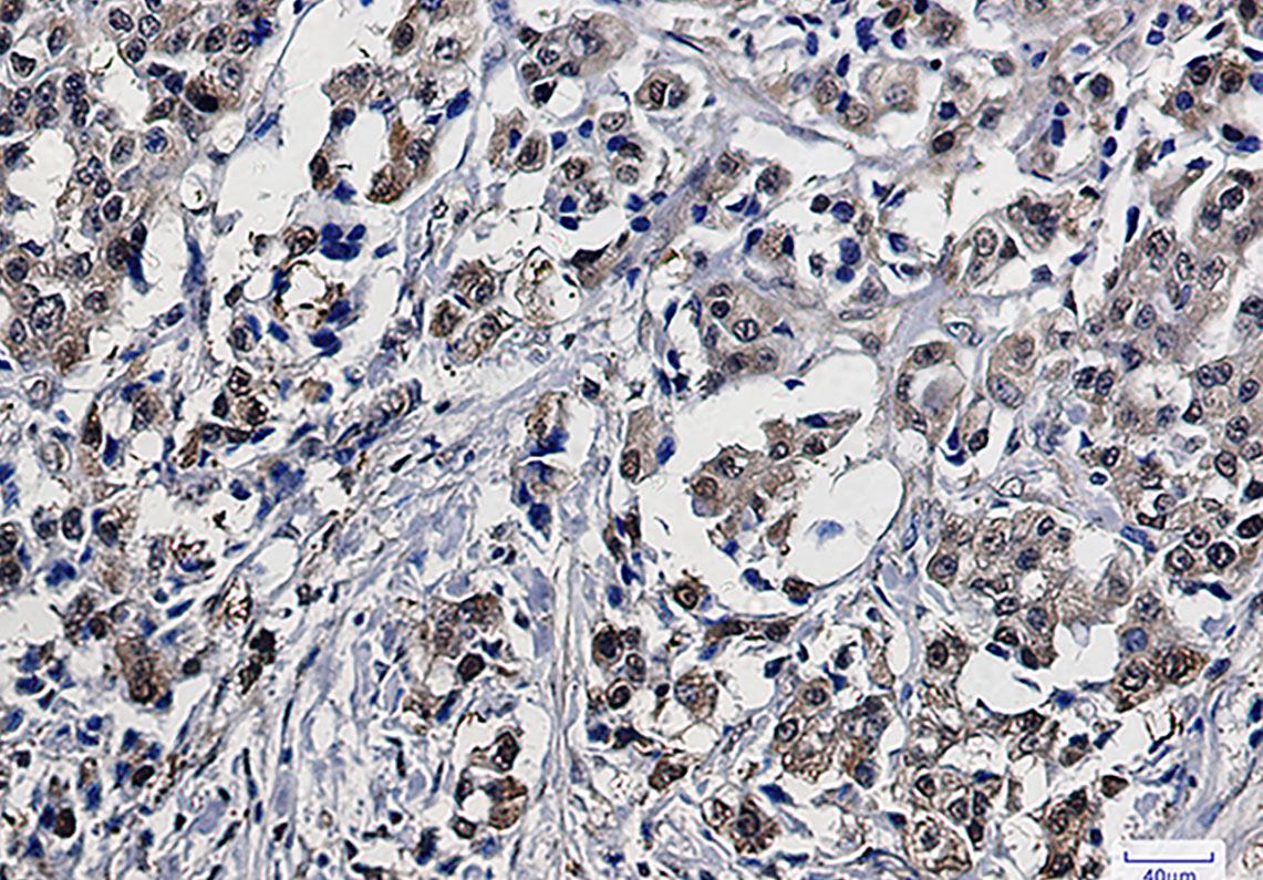 GST3 / GST pi Rabbit mAb ABZ2979