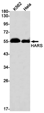 HARS Rabbit mAb ABZ2980