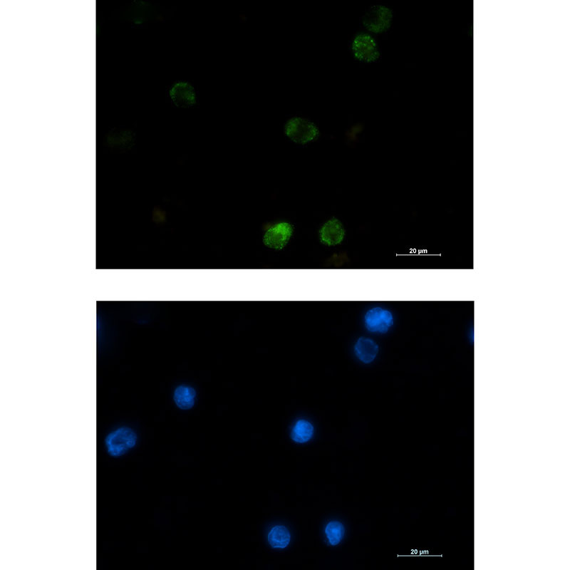 Hexokinase I Rabbit mAb ABZ2985