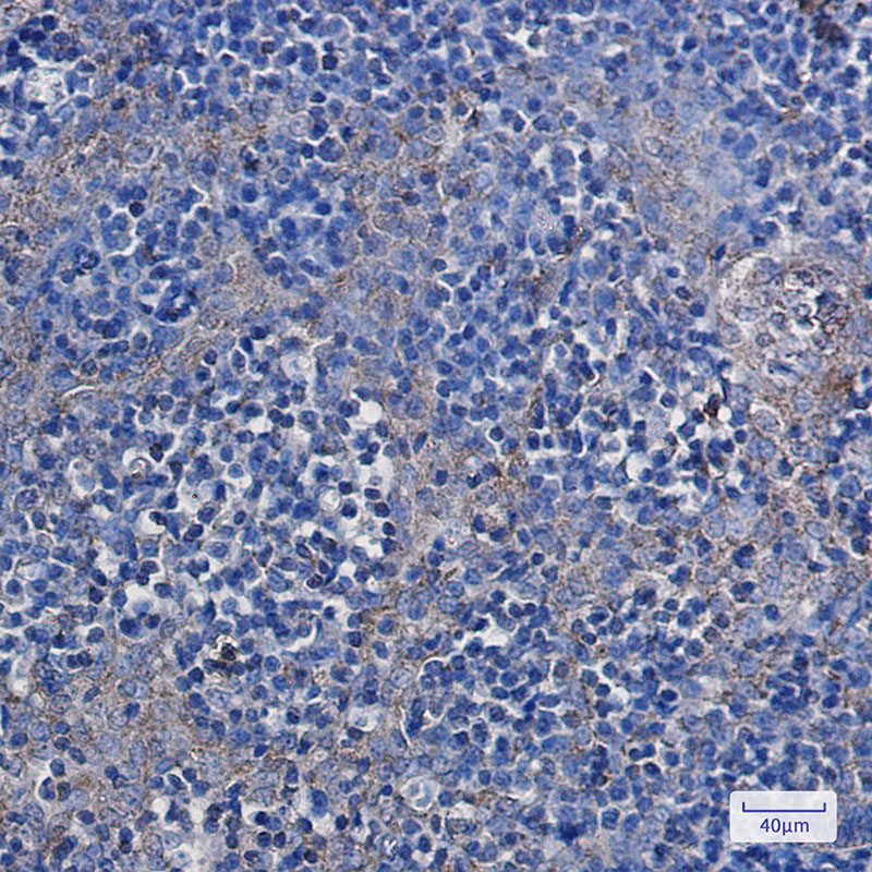 Hexokinase I Rabbit mAb ABZ2985