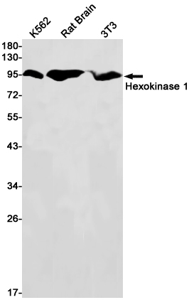 Hexokinase I Rabbit mAb ABZ2985