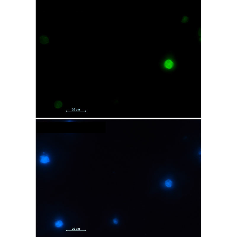 Histone H2A.X Rabbit mAb ABZ2988