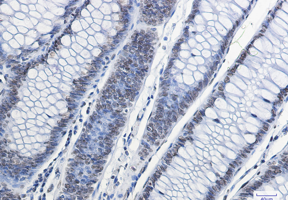 Histone H2A.X Rabbit mAb ABZ2988