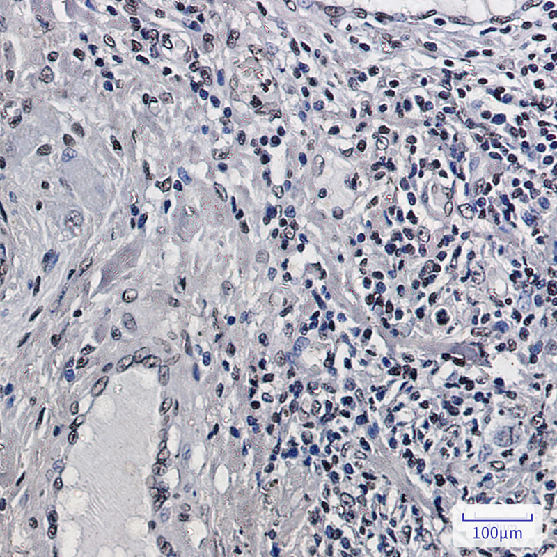 Histone H2B Rabbit mAb ABZ2990
