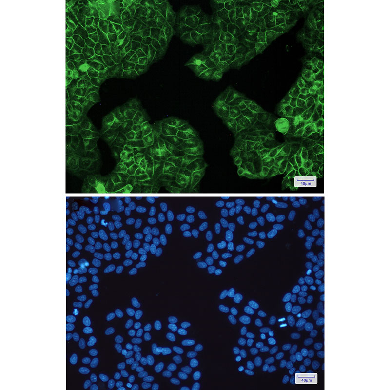 HLA A Rabbit mAb ABZ2991