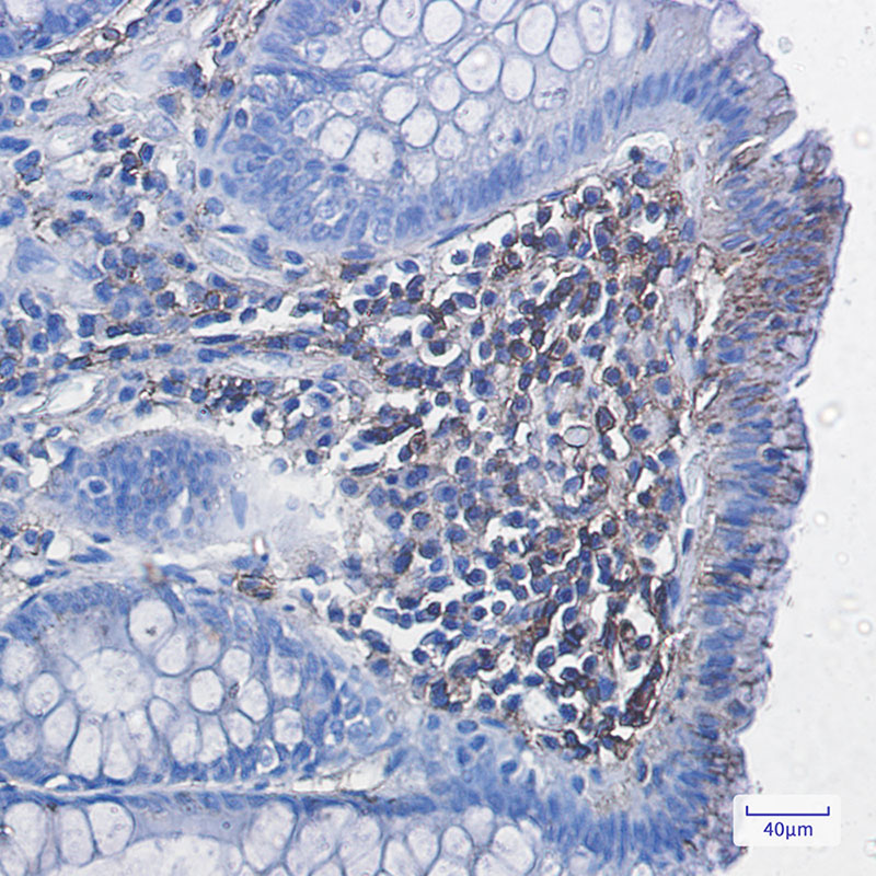 HLA A Rabbit mAb ABZ2991