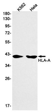HLA A Rabbit mAb ABZ2991