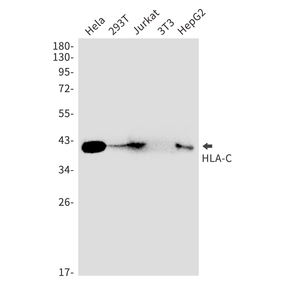 HLA C Rabbit mAb ABZ2992