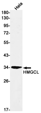HMGCL Rabbit mAb ABZ2993