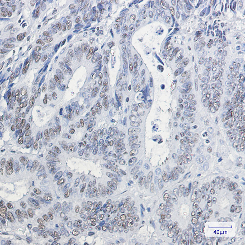 HP1 gamma Rabbit mAb ABZ2996