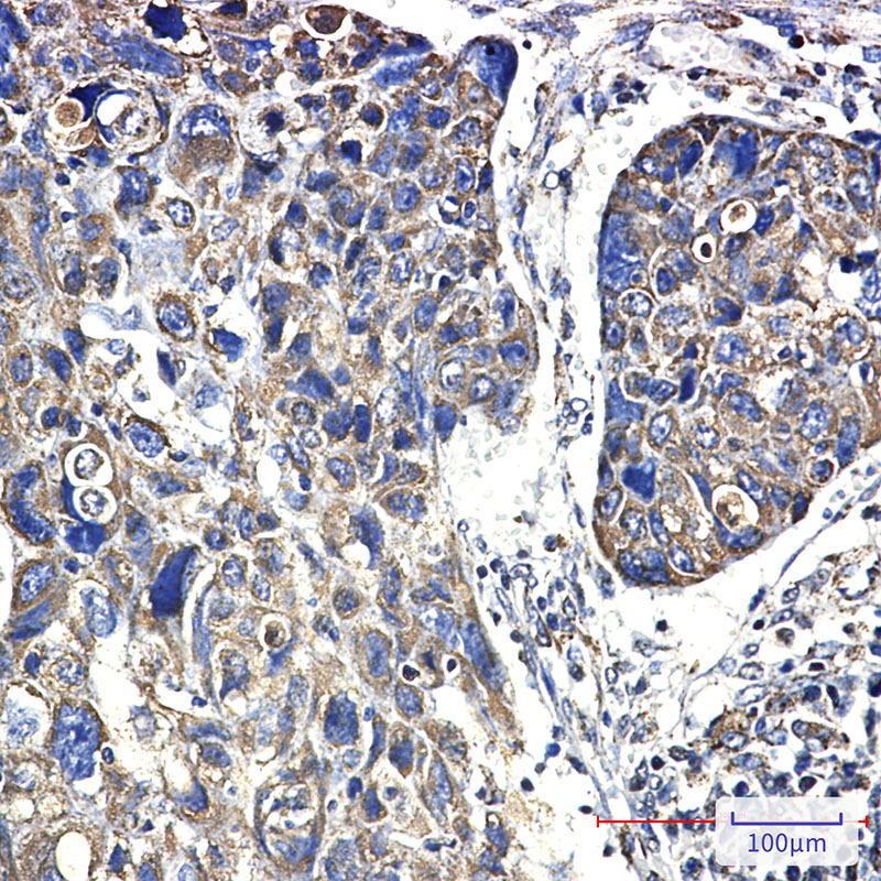Hsp60 Rabbit mAb ABZ3000