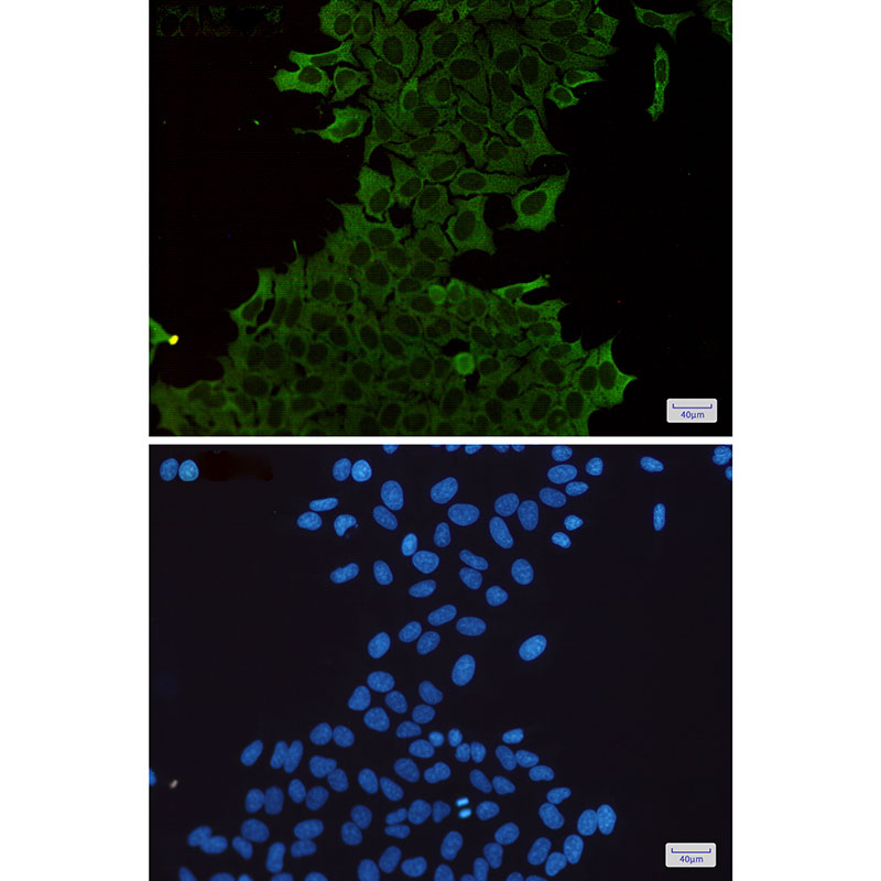 Hsp70 Rabbit mAb ABZ3002