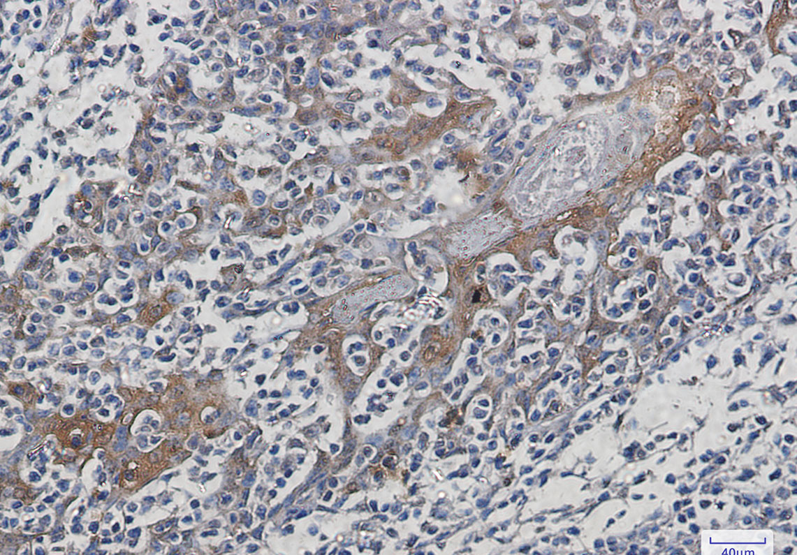 Hsp70 Rabbit mAb ABZ3002
