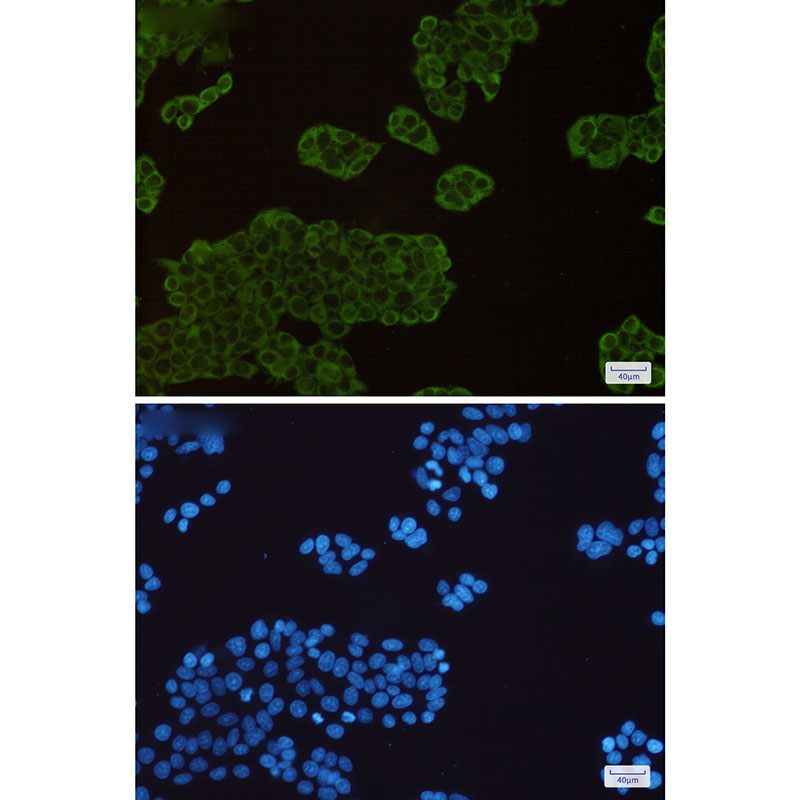 Hsp90 alpha/beta Rabbit mAb ABZ3003
