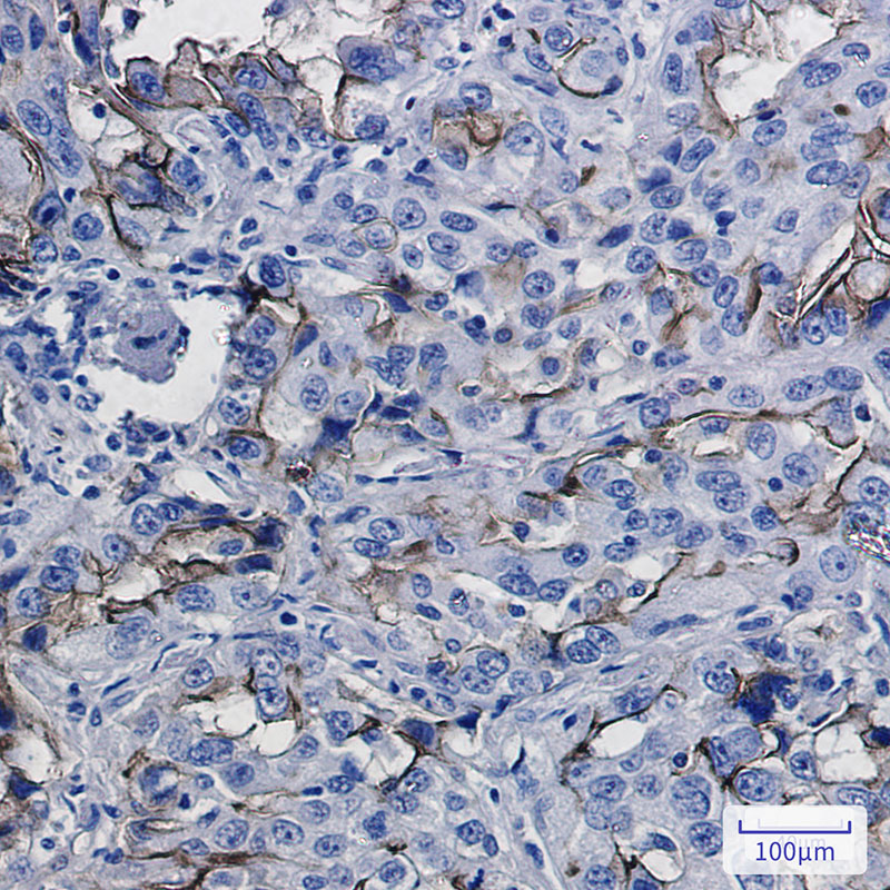ICAM1 Rabbit mAb ABZ3005