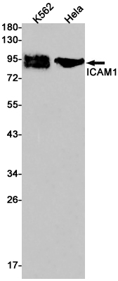ICAM1 Rabbit mAb ABZ3005