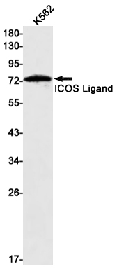 ICOS Ligand/ICOSL Rabbit mAb ABZ3006