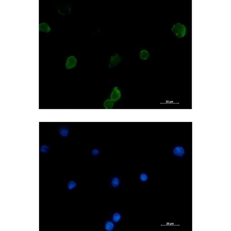 IFITM1 Rabbit mAb ABZ3007