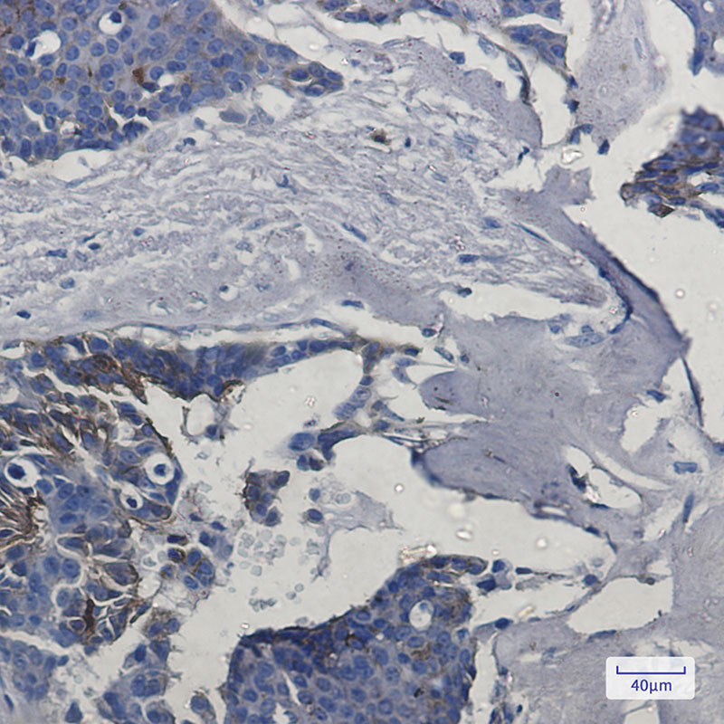 IFITM1 Rabbit mAb ABZ3007