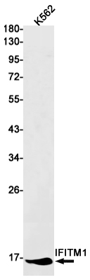 IFITM1 Rabbit mAb ABZ3007