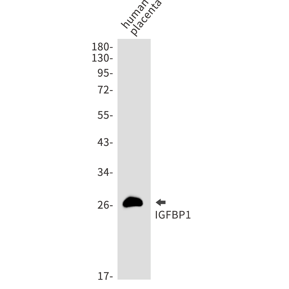 IGFBP1 Rabbit mAb ABZ3008