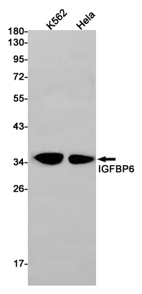 IGFBP6 Rabbit mAb ABZ3010