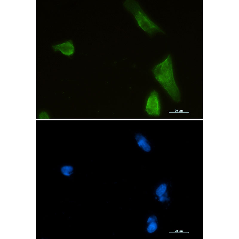 IKK beta Rabbit mAb ABZ3011