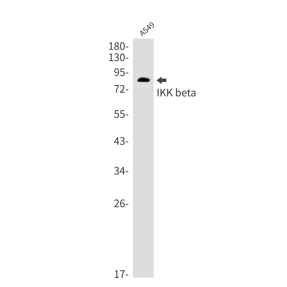 IKK beta Rabbit mAb ABZ3011