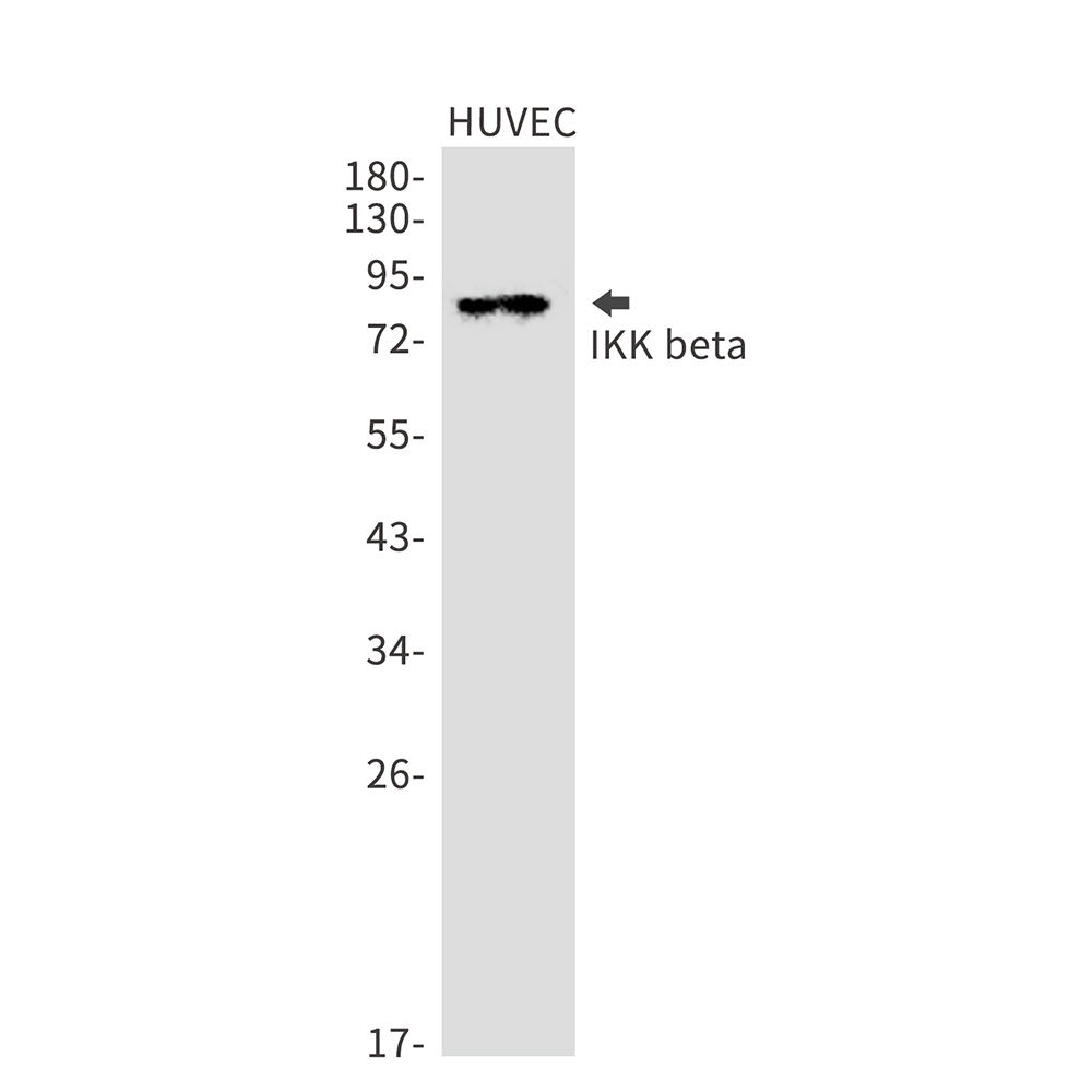 IKK beta Rabbit mAb ABZ3012