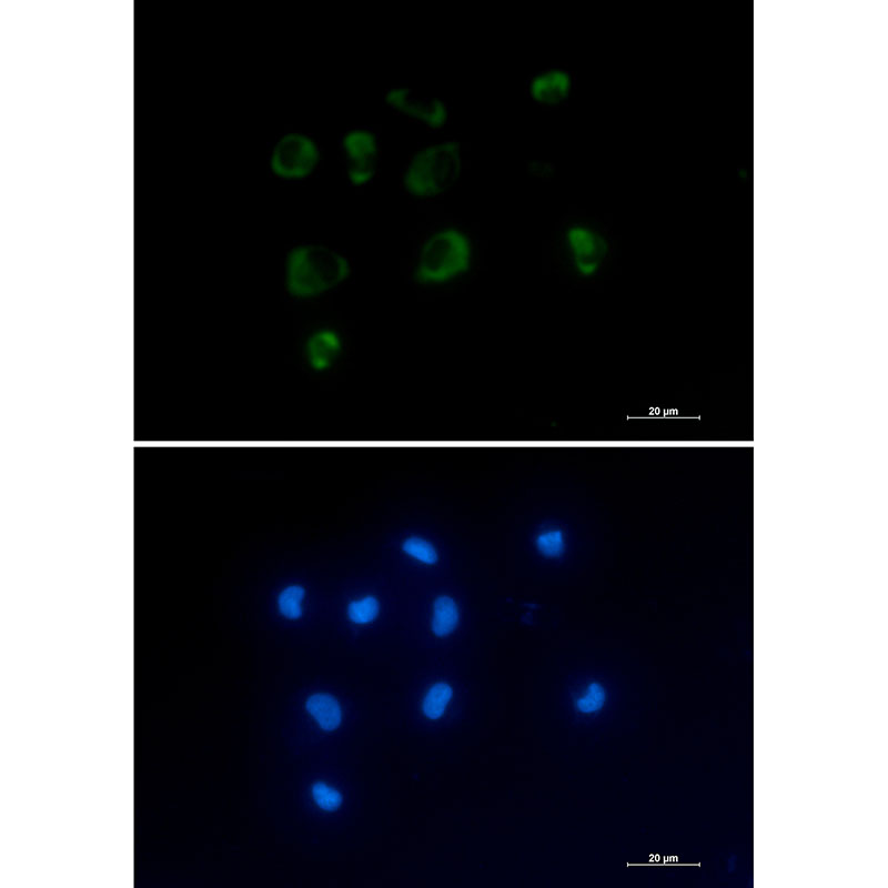 IL-1RA Protein Rabbit mAb ABZ3013
