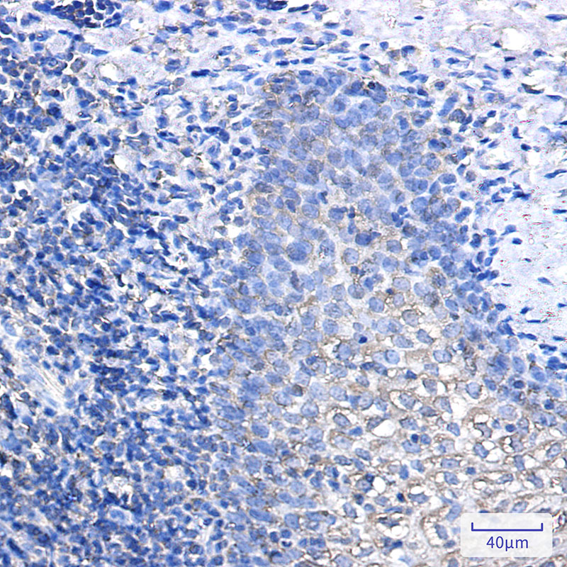 IL-1RA Protein Rabbit mAb ABZ3013