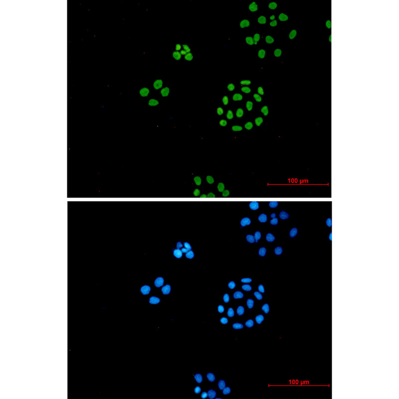 ILF3 Rabbit mAb ABZ3014