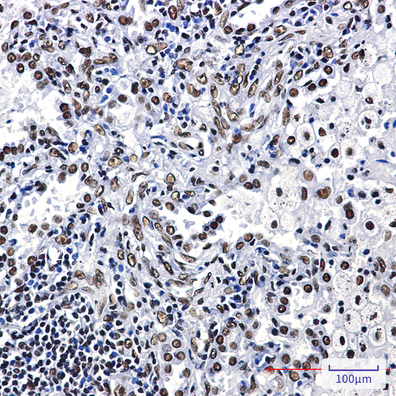 ILF3 Rabbit mAb ABZ3014