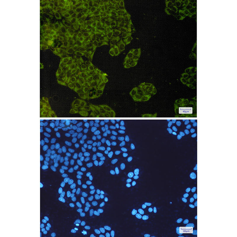 IMP3 Rabbit mAb ABZ3015