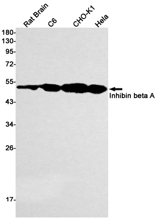 Inhibin beta A Rabbit mAb ABZ3017